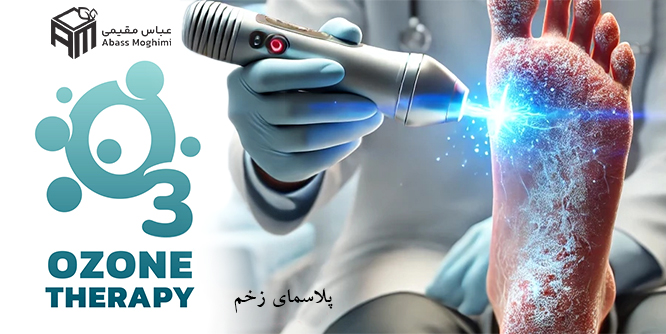 پلاسما تراپی زخم