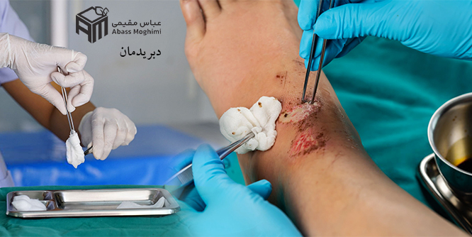 دبریدمان