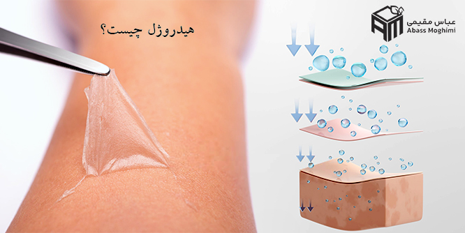هیدروژل چیست؟